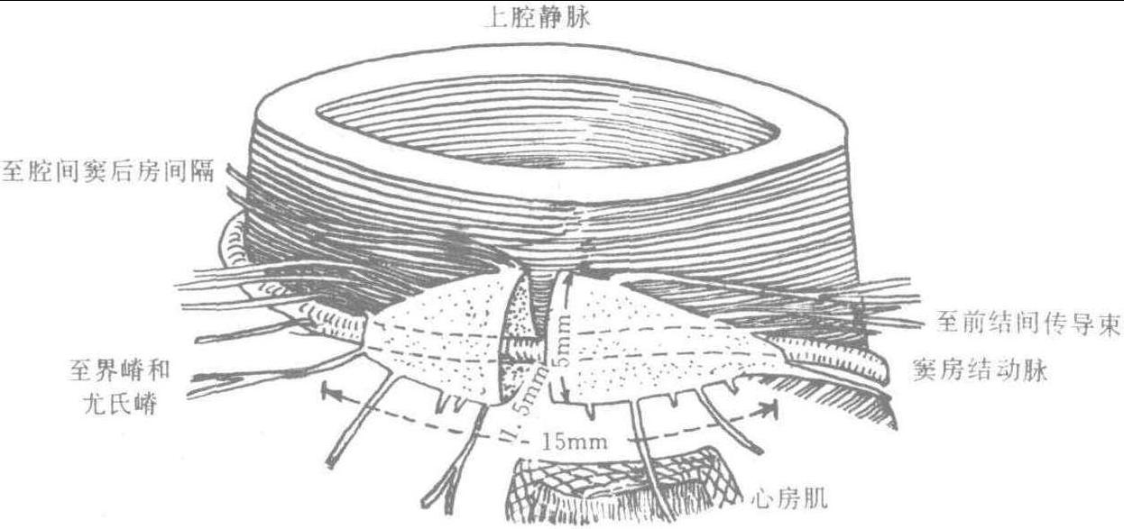 窦房结体表投影位置图片